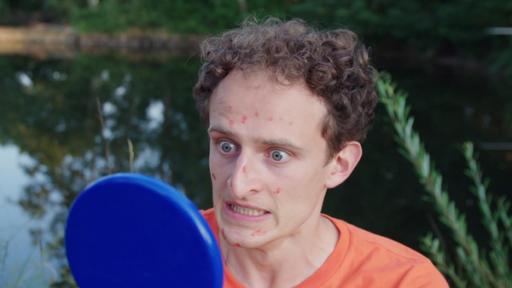Der Allergie-Check | Checker Julian entdeckt: Gegen irgendwas muss er allergisch sein!