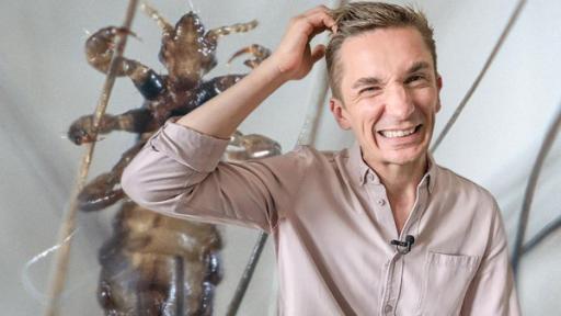 Symbolbild: PUR+ Moderator Eric Mayer steht mit dem Blick in die Kamera und kratzt sich mit der rechten Hand am Kopf. Dabei macht er ein zerknirschtes Gesicht. Im Hintergrund sieht man in Großaufnahme eine Kopflaus von unten die sich an Fäden festhält.